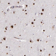 NBP1-82205 - NUP62CL