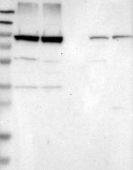 NBP1-81546 - NUP93