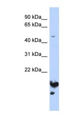 NBP1-53047 - NUSAP1 / ANKT