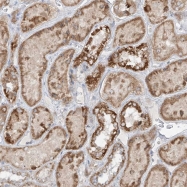 NBP1-89508 - NVL