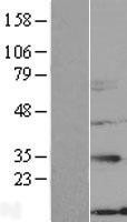 NBL1-13892 - NXNL2 Lysate