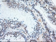 NBP1-47892 - Neurotrophin 3 / NTF3