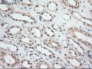 NBP1-47892 - Neurotrophin 3 / NTF3