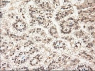 NBP1-47892 - Neurotrophin 3 / NTF3