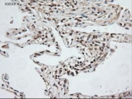 NBP1-47892 - Neurotrophin 3 / NTF3
