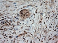 NBP1-47892 - Neurotrophin 3 / NTF3