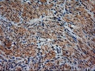 NBP1-47892 - Neurotrophin 3 / NTF3
