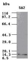 NBP1-47892 - Neurotrophin 3 / NTF3