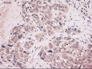 NBP1-47897 - Neurotrophin 4 / NTF4