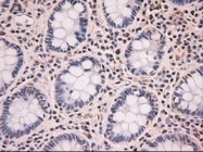 NBP1-47897 - Neurotrophin 4 / NTF4