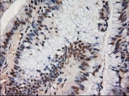NBP1-47897 - Neurotrophin 4 / NTF4