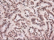 NBP1-47897 - Neurotrophin 4 / NTF4