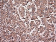 NBP1-47897 - Neurotrophin 4 / NTF4