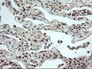 NBP1-47897 - Neurotrophin 4 / NTF4