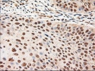 NBP1-47897 - Neurotrophin 4 / NTF4