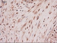 NBP1-47897 - Neurotrophin 4 / NTF4