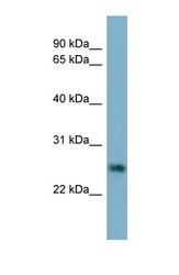 NBP1-59313 - Neurotrophin 4 / NTF4