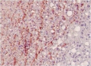 NB110-2023 - Nitrotyrosine