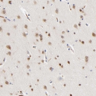 NBP1-86517 - NOVA1