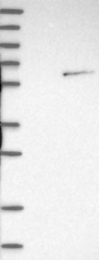 NBP1-86517 - NOVA1