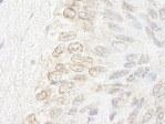 NB100-93322 - NUP35