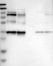 NBP1-92214 - NUP35