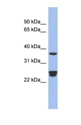 NBP1-70661 - OAZ2