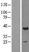 NBL1-13899 - OBFC1 Lysate