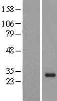 NBL1-13900 - OBFC2B Lysate