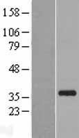 NBL1-13903 - OCIAD1 Lysate