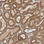 NBP1-80973 - OCRL