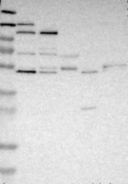 NBP1-80973 - OCRL