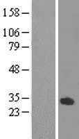 NBL1-13909 - ODF3L1 Lysate