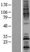 NBL1-13910 - ODF4 Lysate