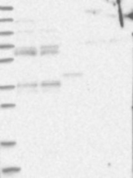 NBP1-89356 - OFD1