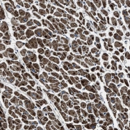 NBP1-84947 - OGDH