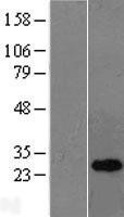NBL1-13920 - OIP5 Lysate