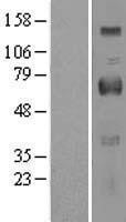 NBL1-13921 - OIT3 Lysate