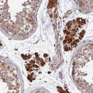 NBP1-92223 - Olfactory receptor 14J1