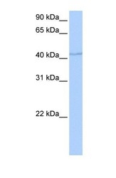 NBP1-56693 - DPH1 / OVAC1