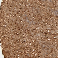 NBP1-89469 - OVOL1