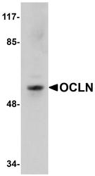 NBP1-77037 - Occludin