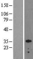 NBL1-14015 - Otx2 Lysate