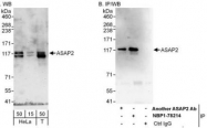 NBP1-78214 - ASAP2 / DDEF2