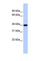NBP1-70670 - LPPR5 / PAP2D