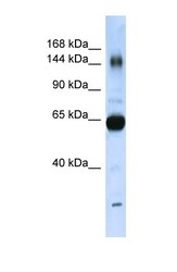 NBP1-59276 - Collagen type XI alpha 2 chain
