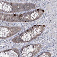 NBP1-84297 - PCBD1