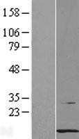 NBL1-14140 - PCBD1 Lysate