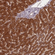 NBP1-83241 - PCBP2 / hnRNP-E2