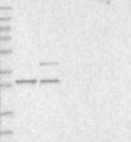NBP1-83241 - PCBP2 / hnRNP-E2